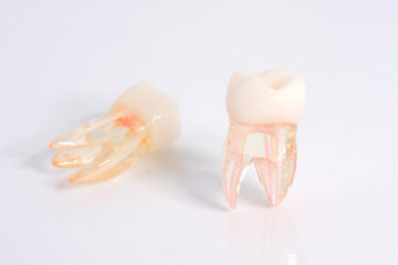 Endodontie-Modell